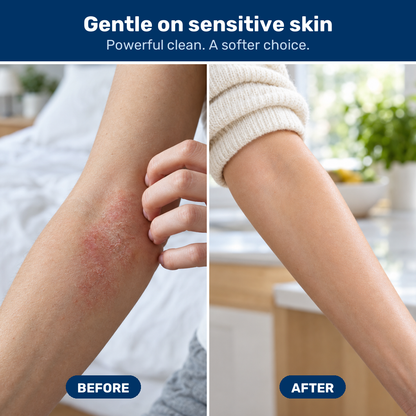 Gentle on sensitive skin, before and after